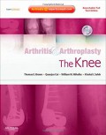 Arthritis & arthroplasty : the knee